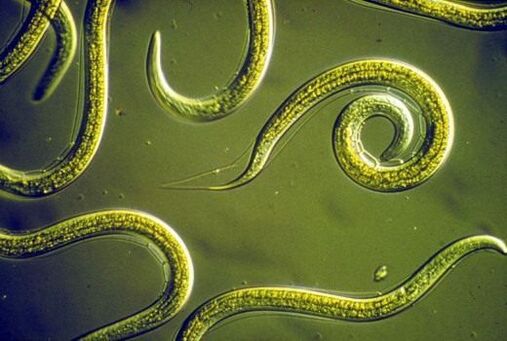 Parasitäre Nematoden Würmer am mënschlechen Dënndarm